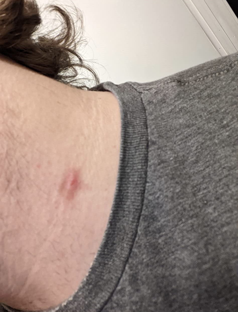 TagRecede Bee Venom Spray
