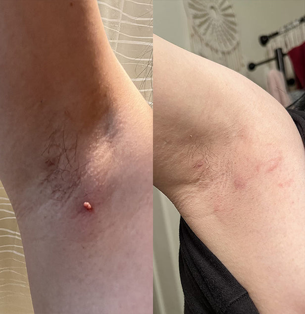 TagRecede Bee Venom Spray