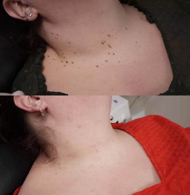 TagRecede Bee Venom Spray