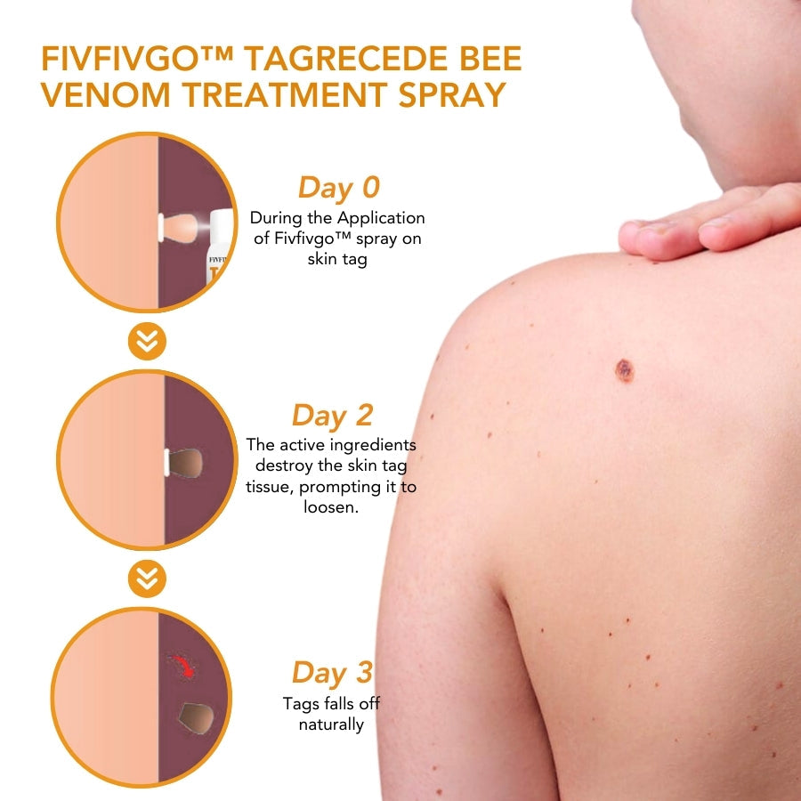 TagRecede Bee Venom Spray