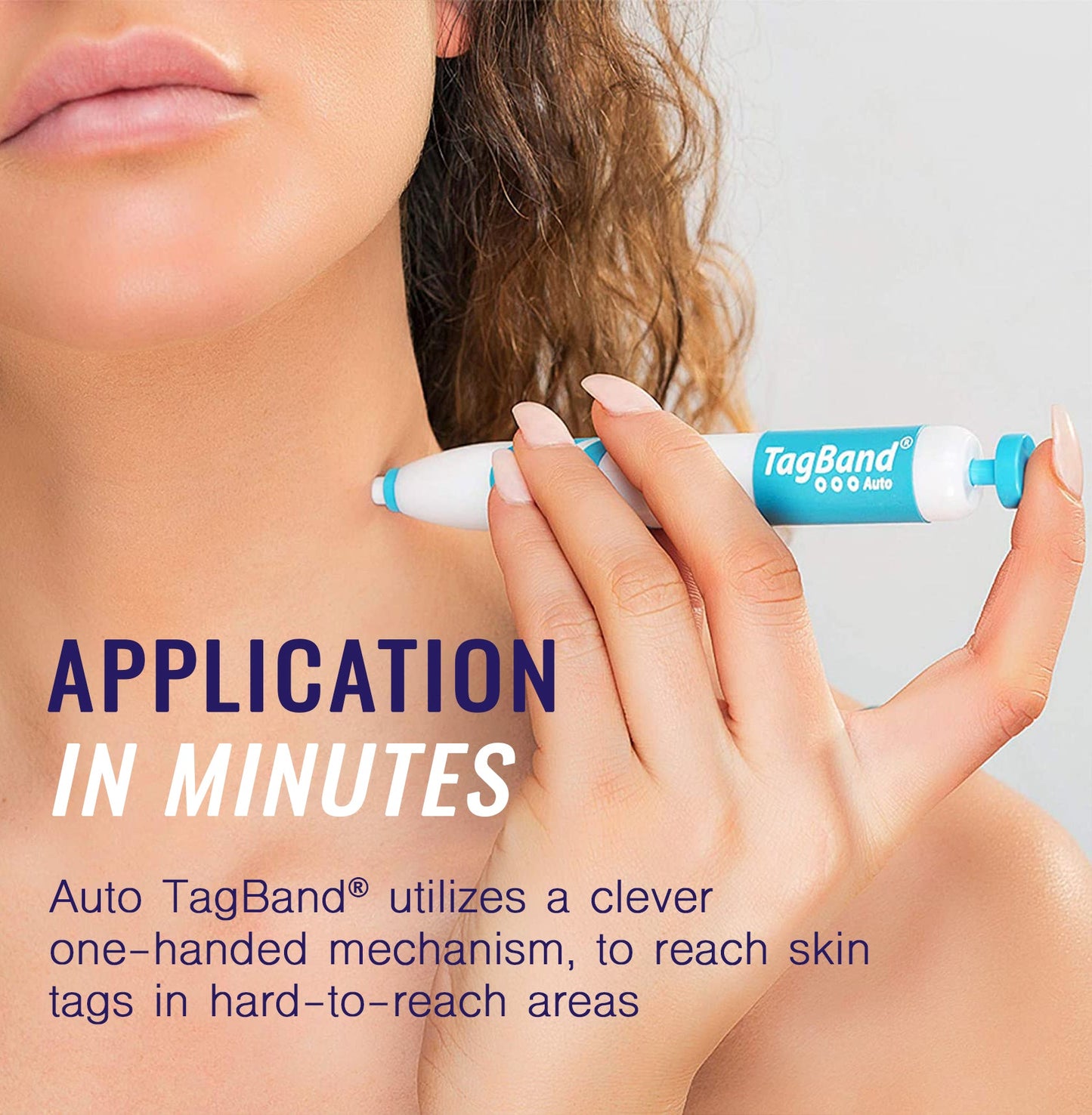 TagBand Skin Tag Remover